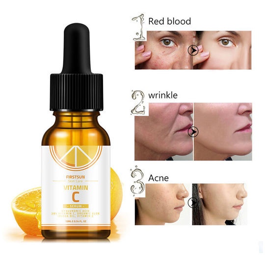 Anti-Brown Spot Serum - Face Care Enriched with Vitamin C, Salicylic Acid and Niacinamide - For All Skin Types - 10 ml