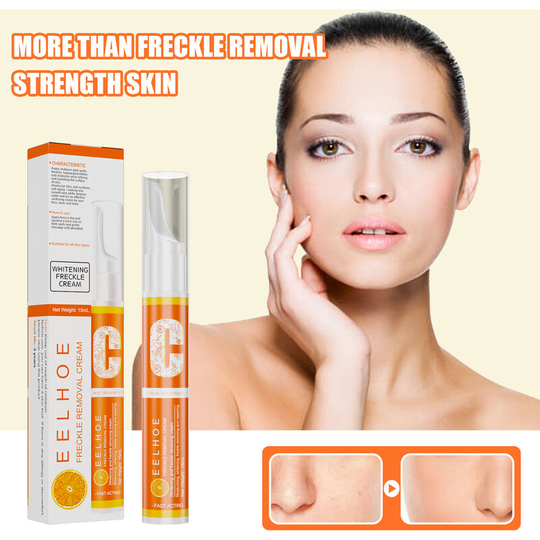 Face Vitamin c Serum, Vitamin c Serum With Hyaluronic Acid and Vitamin e - Anti-Wrinkle, Anti-Aging and Anti-Dark Spot Women's Face Care (15ml)